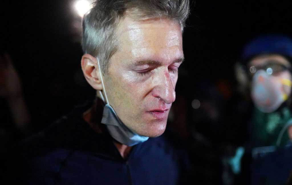 Portland Mayor Ted Wheeler reacts after being exposed to tear gas